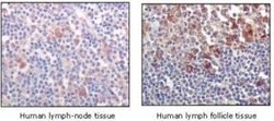 BTK Antibody (7F12H4) - Azide and BSA Free, Novus Biologicals 0.1 mL; Unconjugated:Antibodies,